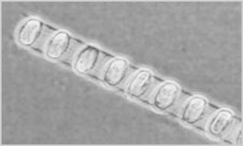 形似硅藻的链状单细胞浮游植物长度从不足1μm到接近1 mm