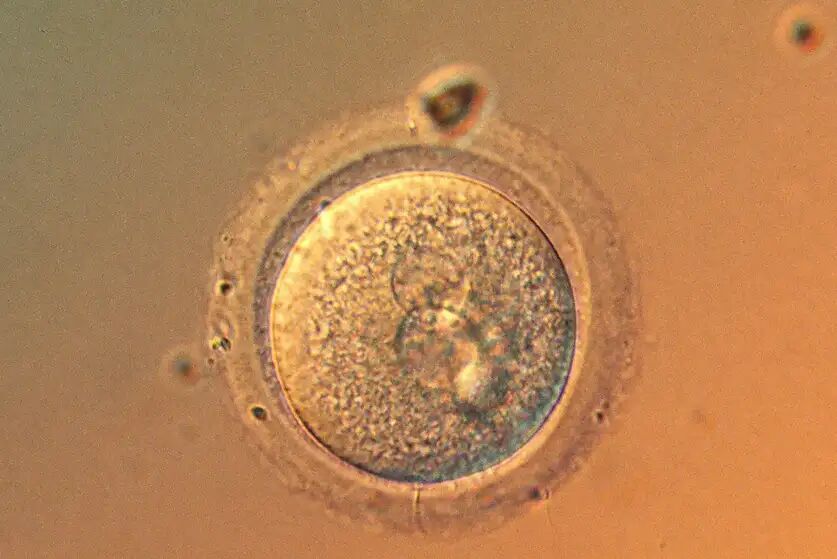 pic-1