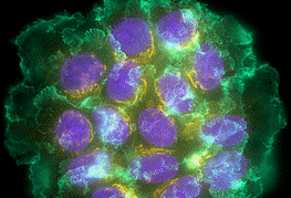 Cancerous cells
