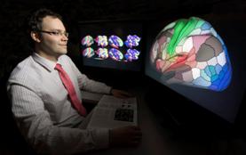 Matthew Glasser, PhD, led a team that mapped the human cerebral cortex in painstaking detail. The map will help researchers study brain disorders such as autism, schizophrenia, dementia and epilepsy.